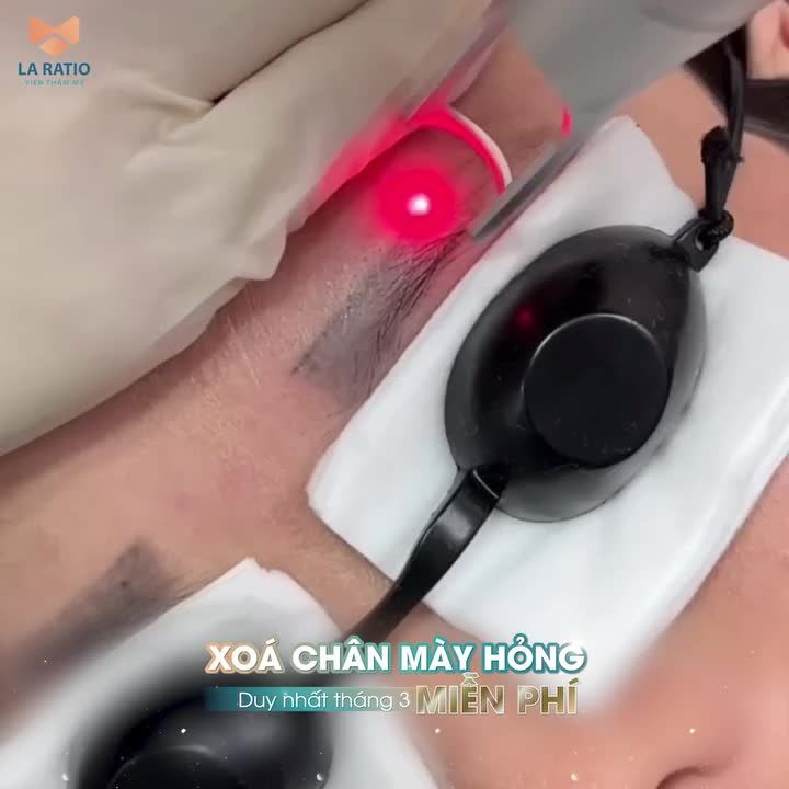 DUY NHẤT THÁNG 3 - Xóa chân mày hỏng MIỄN PHÍ