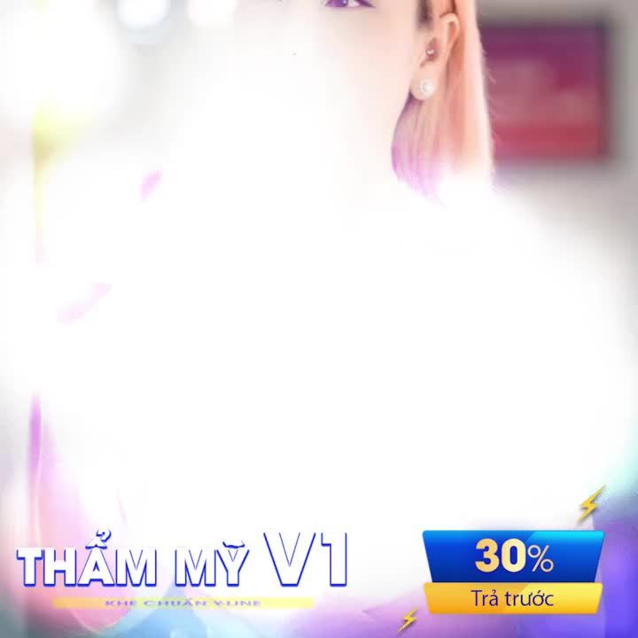 Vòng 1 sau 4 tháng nâng cấp bằng công nghệ SVF tại EMCAS. Chính tay Bác sĩ Khiêm với kinh nghiệm hơn ¼ thế kỷ trong ngành làm đẹp thực hiện.