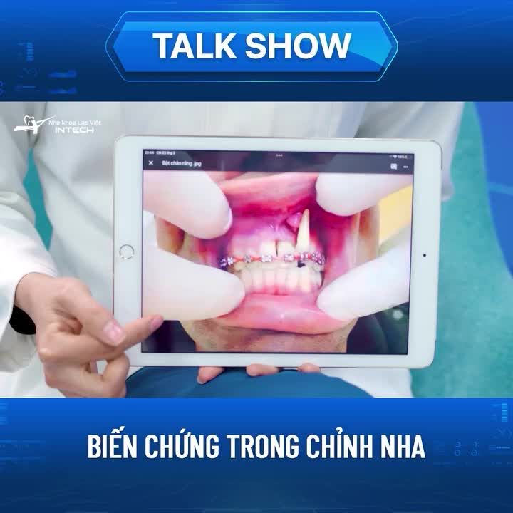 CHUYÊN GIA GIẢI ĐÁP: BIẾN CHỨNG BẬT CHÂN RĂNG RA KHỎI Ổ RĂNG KHI NIỀNG RĂNG VÀ GIẢI PHÁP
