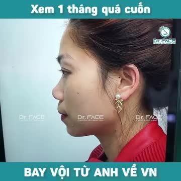 Xem BS “QUÁ CUỐN”, bay vội TỪ ANH VỀ VN nâng mũi