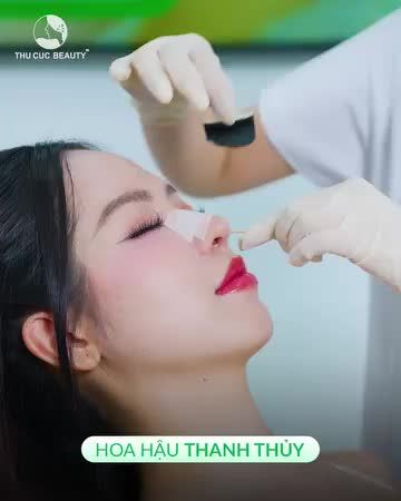 Nâng mũi cho hoa hậu Thanh Thủy