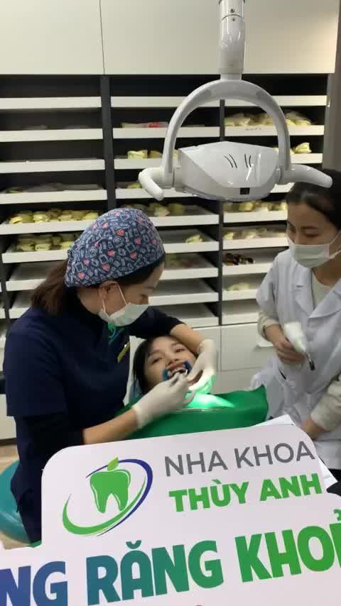 Cận cảnh quá trình gắn mắc cài hàm dưới bắt đầu quá trình chỉnh nha khắc phục tình trạng răng hô, thay thế răng mất cho bạn Thanh.