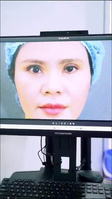 3 lần phẫu thuật hỏng, đôi mắt của vị khách hàng đã được Bác sĩ Hải Lê "giải cứu" như thế nào?