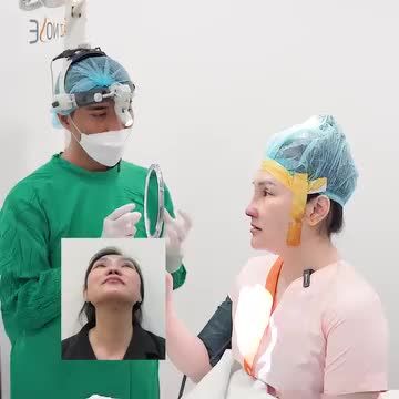 Khắc phục đầu mũi c.o r.út nặng sau 1 năm tháo sóng