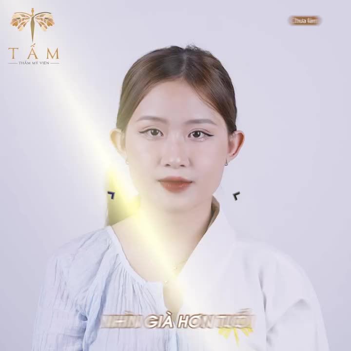KHẲNG ĐỊNH CHẤT LƯỢNG - TRỌN VẸN NIỀM TIN TỪ KHÁCH HÀNG VỚI CÔNG NGHỆ THON GỌN HÀM VLINE PERFECT