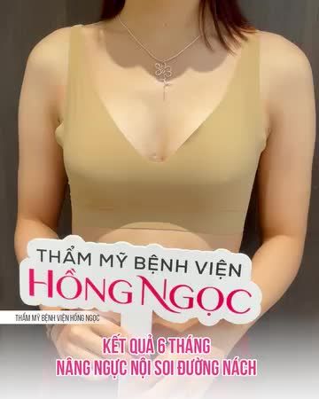 NGỰ.C SIÊU TỰ NHIÊN SAU 6 THÁNG NÂNG CẤP
