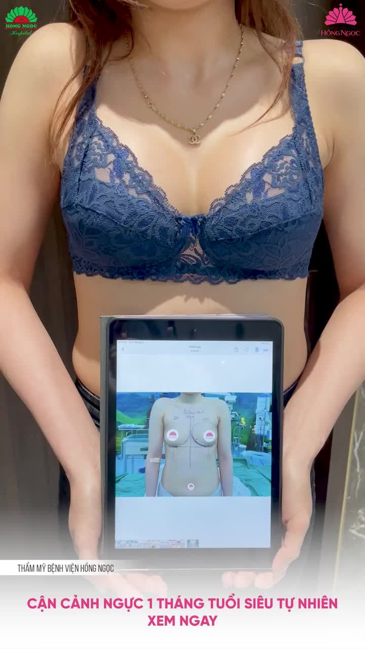 THÍCH SEXY VÀ CÁI KẾT NHƯ Ý SAU 1 THÁNG NÂNG NGỰC