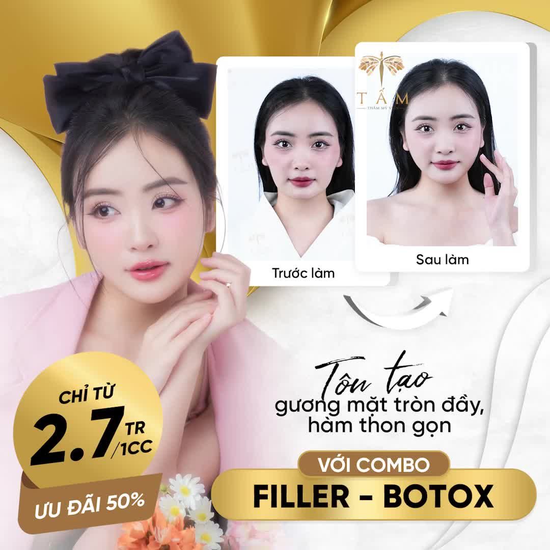 TÔN TẠO GƯƠNG MẶT TRÒN ĐẦY, HÀM THON GỌN VỚI COMBO FILLER - BOTOX