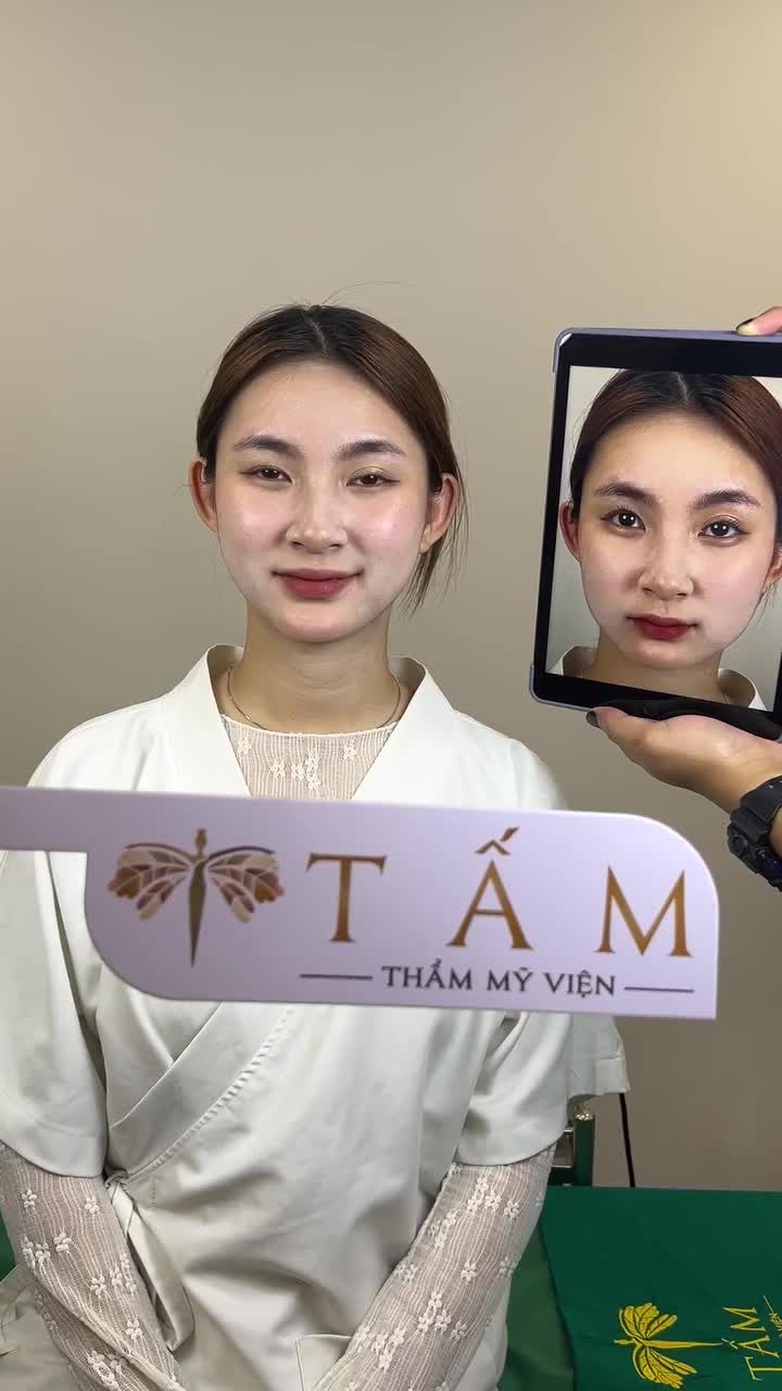 TÍN HIỆU VŨ TRỤ "BẠN SẼ HỐI HẬN NẾU KHÔNG LÀM COMBO BOTOX HÀM+FILLER CẰM" NGAY!
