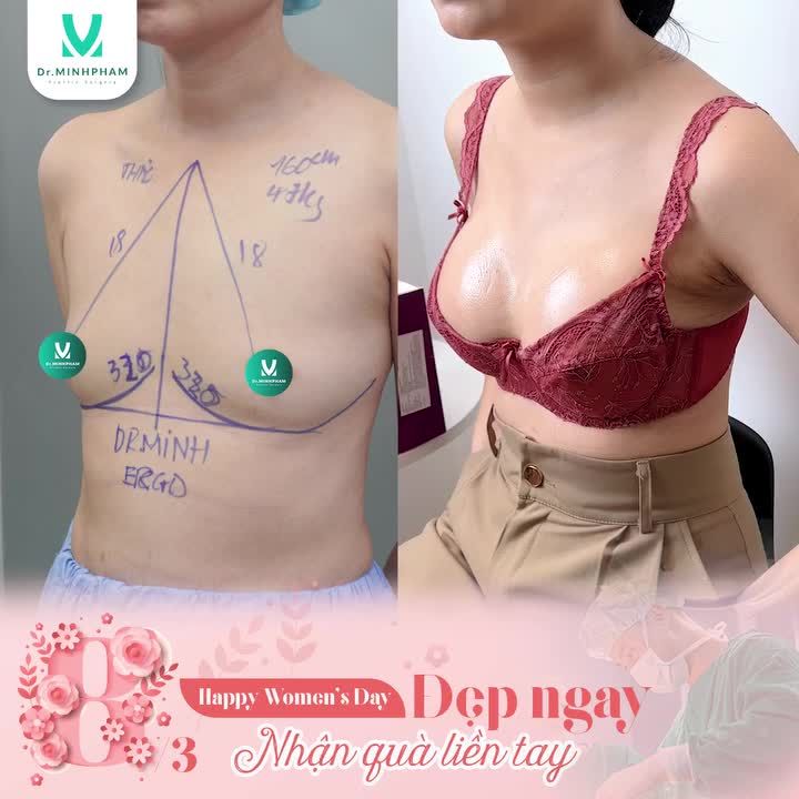 VÒNG 1 TỰ TIN - NÂNG TẦM VẺ ĐẸP!
