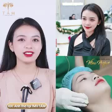 THẾ NÀO LÀ MỘT CHIẾC HÀM THON GỌN THAY ĐỔI CẢ GƯƠNG MẶT