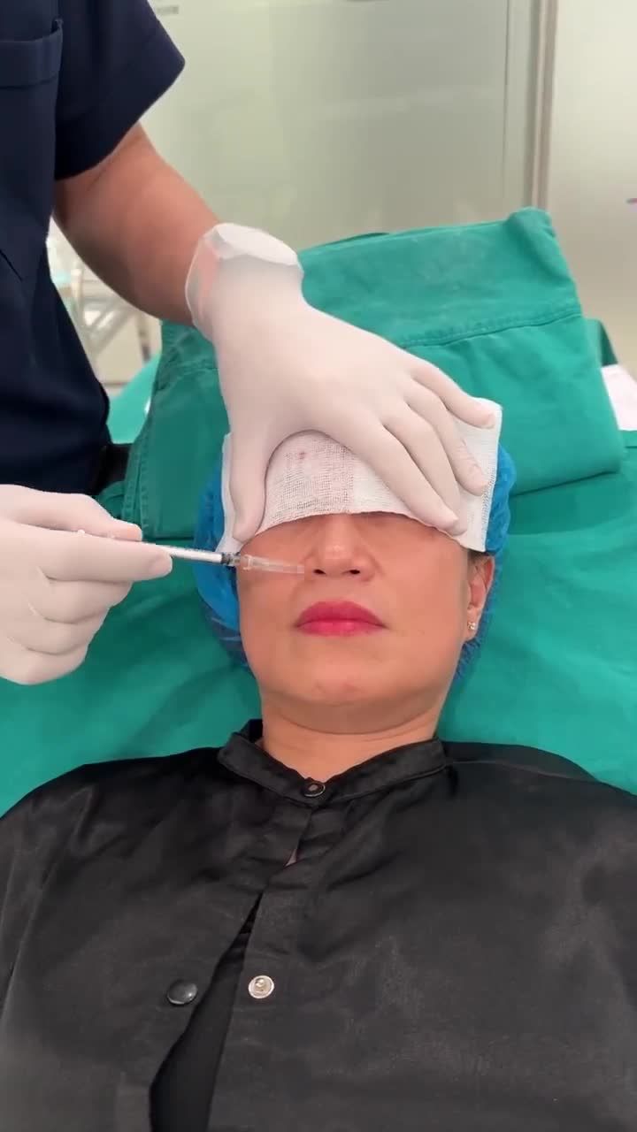 BÁC SĨ ĐIỀN TIẾP TỤC TIÊM XÓA NHĂN RÃNH MŨI MÁ CA TIẾP THEO - CHỊ KHÁCH HÀNG ĐẾN TỪ HẢI PHÒNG.