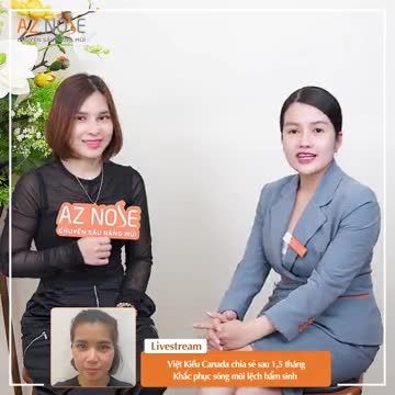 Việt Kiều Canada sau 1,5 tháng khắc phục sóng mũi lệch bẩm sinh