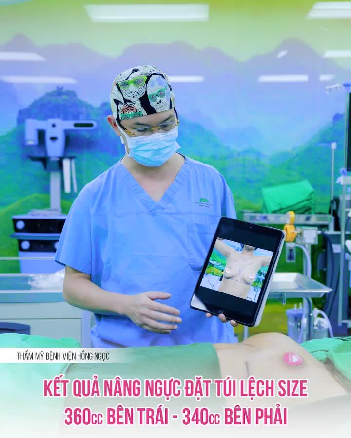 Ngực tròn đầy, cân đối ngay sau 60p