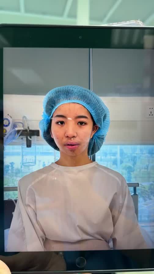 Pt chỉnh 2 hàm, trượt cằm cho bệnh nhân 16t