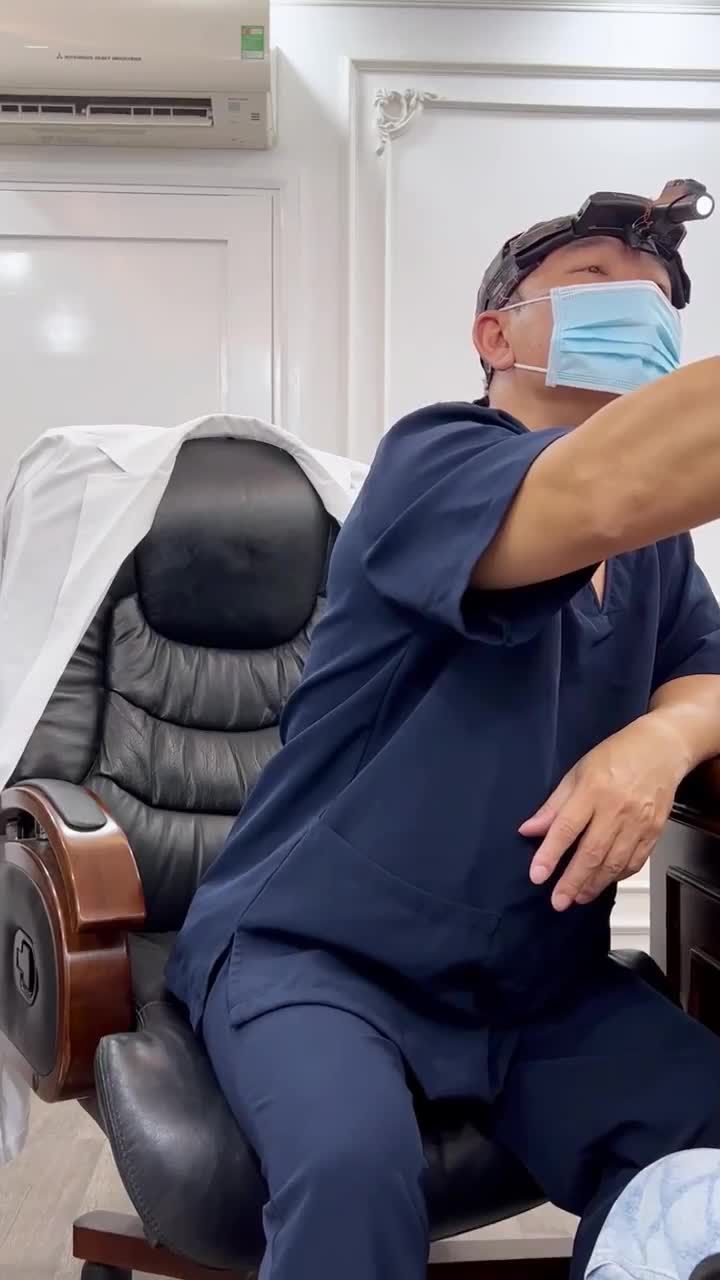 Chị gái đã làm mũi 10 năm trước ở nơi khác, đến Latin tư vấn nâng mũi tái cấu trúc