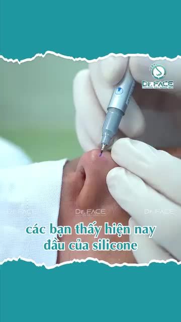 Để Lâu Thêm Nữa Mũi Th.ủng Da Cho Coi…