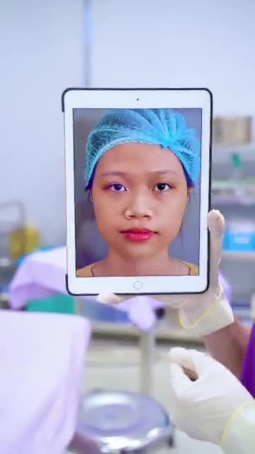 Em gái "thăng hạng" nhan sắc nhờ dáng mũi cao tinh tế, đẹp tự nhiên tại Dr.Hải Lê!