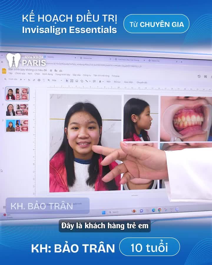 Xem thêm 993 video Niềng Răng của bác sĩ Bs nha khoa Paris