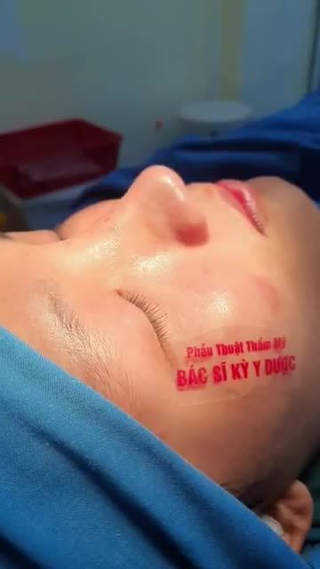 Chỉ với một thay đổi nhỏ trên khuôn mặt khiến bạn ấy thay đổi rõ rệt, nam tính và nổi bật hơn.