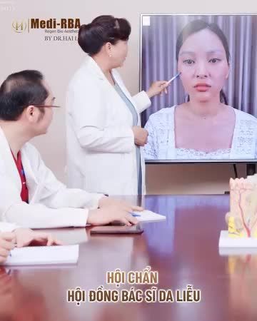 Medi-RBA là phác đồ chuyển hóa nám ưu việt số 1 gần đây được rất nhiều chị em ưa chuộng.