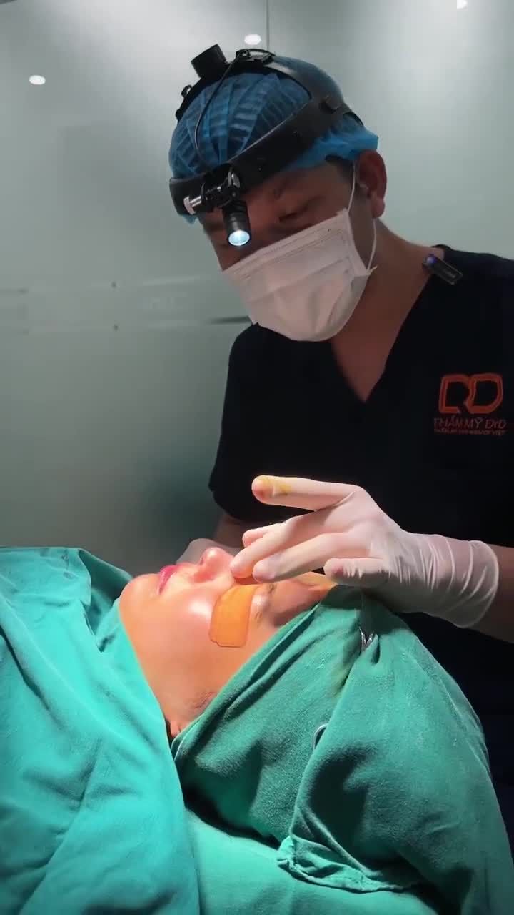 BÁC SĨ LÊ HỮU ĐIỀN ĐÃ THỰC HIỆN XONG CA TIỂU PHẪU NÂNG MŨI.
