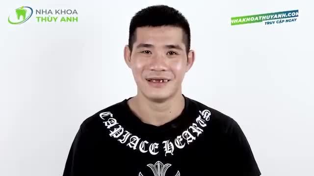 KHÔI PHỤC HÀM RĂNG CHO ANH KHÁCH HÀNG KHÔNG MAY MẤT NHIỀU RĂNG DO TAI NẠN