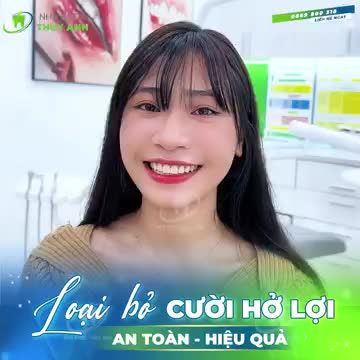 DẸP BỎ NGẠI NGÙNG VÌ CƯỜI HỞ LỢI CHỈ VỚI 45 PHÚT TẠI NHA KHOA THUỲ ANH