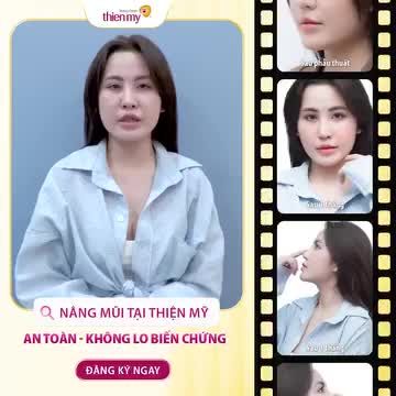 NHAN SẮC RẠNG NGỜI SAU KHI NÂNG MŨI TẠI THIỆN MỸ