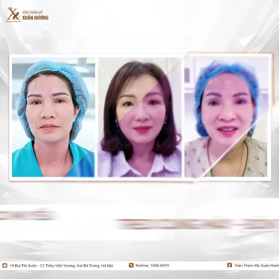 NÂNG CUNG MÀY: ĐẸP NGAY SAU 5 NGÀY