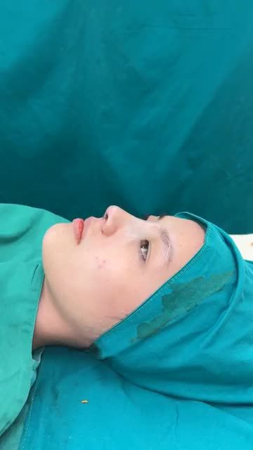 Case mũi cấu trúc vừa hoàn thành