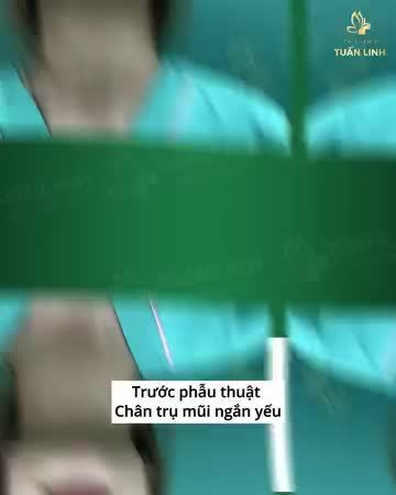 Chọn đúng địa chỉ nâng mũi quan trọng như thế nào?