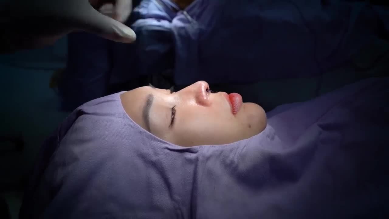 Nâng mũi Dr.Hải Lê - 60 phút sở hữu dáng mũi đẹp mọi góc nhìn!