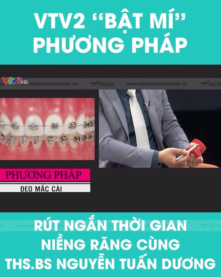 VTV2 "BẬT MÍ" CÔNG NGHỆ RÚT NGẮN THỜI GIAN NIỀNG RĂNG CÙNG THS BS NGUYỄN TUẤN DƯƠNG
