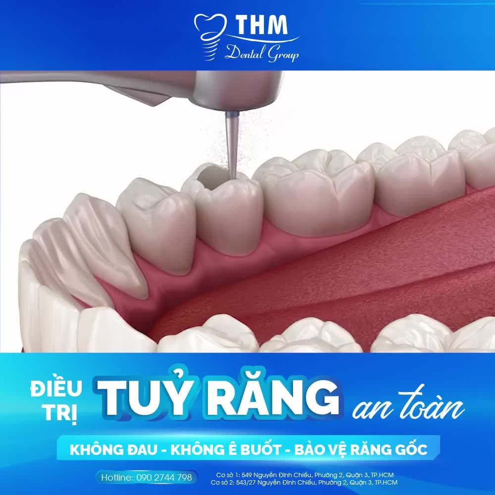 ĐIỀU TRỊ TỦY RĂNG AN TOÀN TẠI NHA KHOA THẾ HỆ MỚI