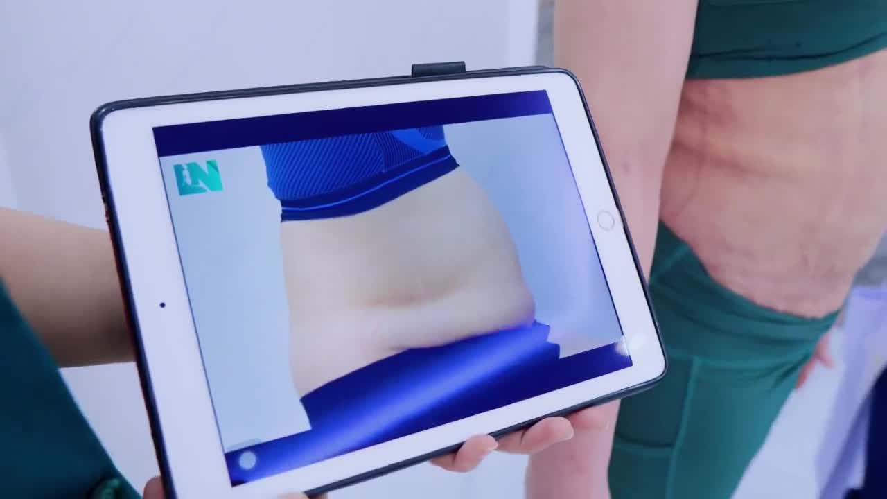 Không còn khó khăn, nặng nề khi sinh hoạt như trước đây với vòng bụng quá cỡ, sồ sề