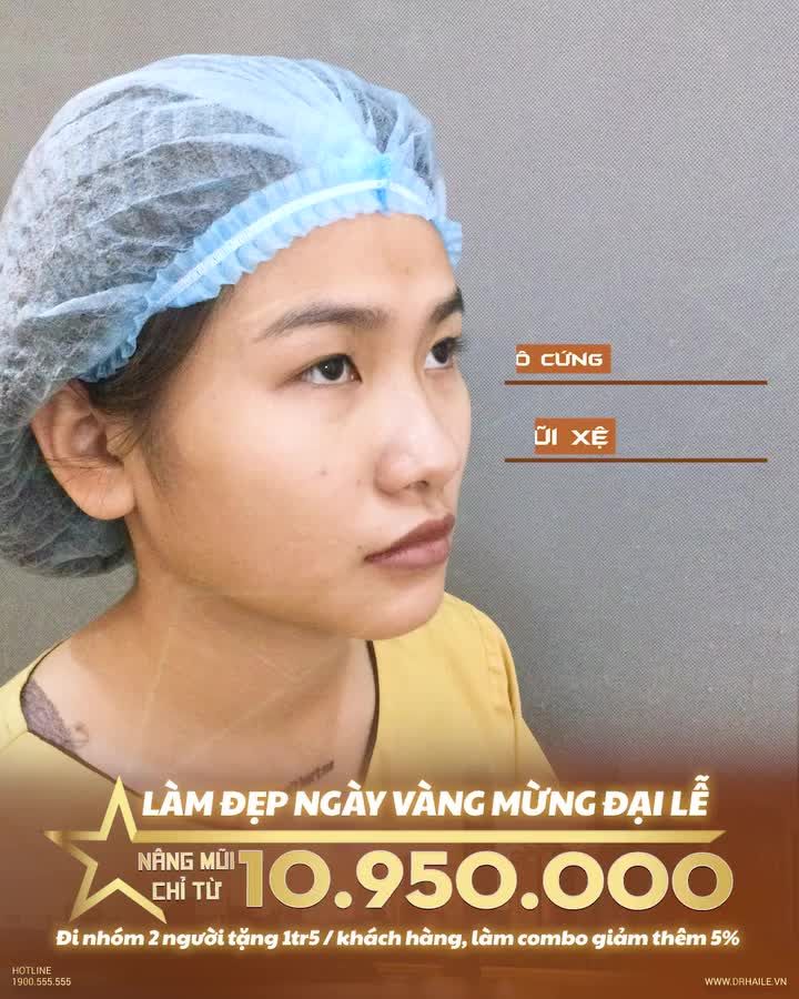 Xem thêm 2399 video Nâng Mũi của bác sĩ Dr Hải Lê