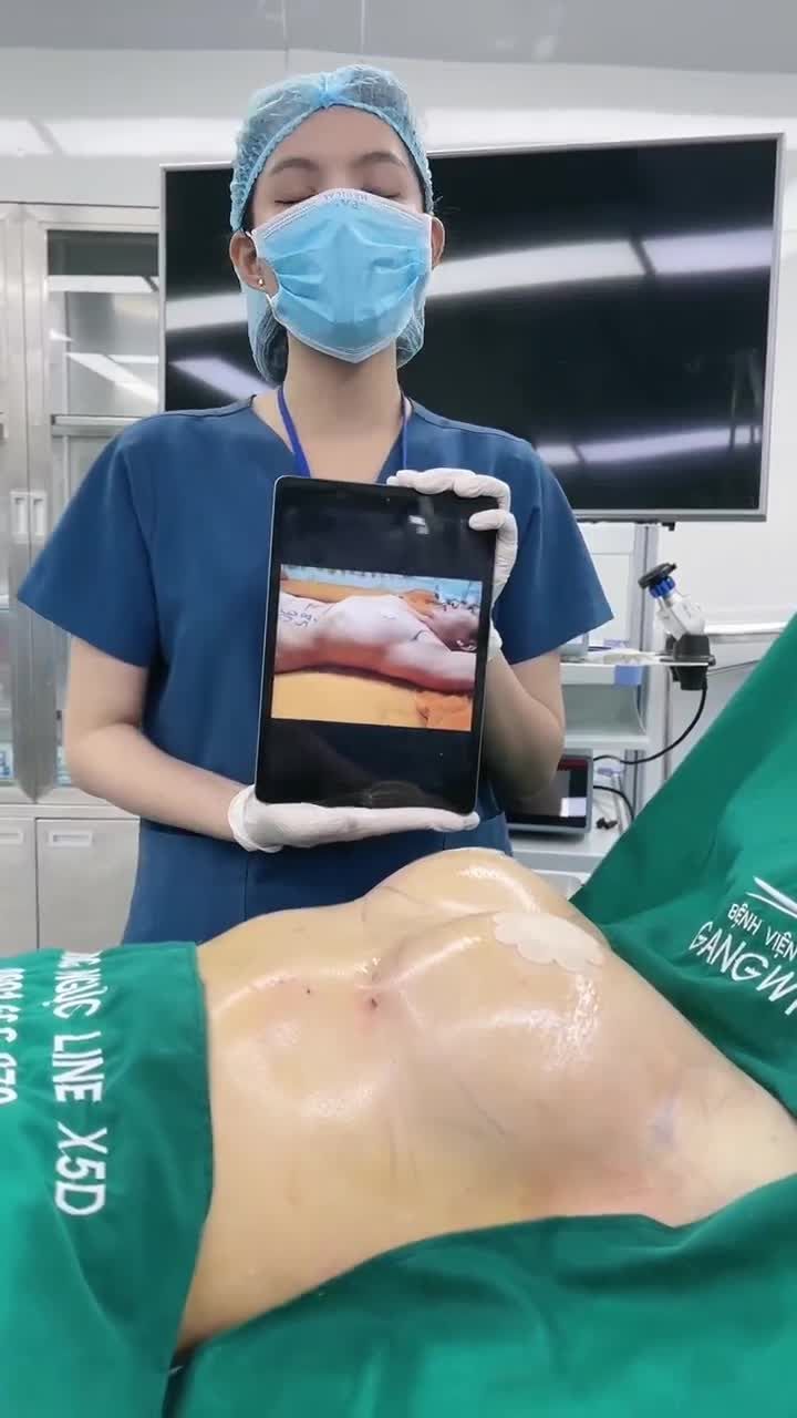GANGWHOO NÂNG CẤP VÒNG 1 CĂNG TRÀN SỨC SỐNG CHO CHỊ KHÁCH HÀNG LUÔN TỰ TI VỀ BẢN THÂN