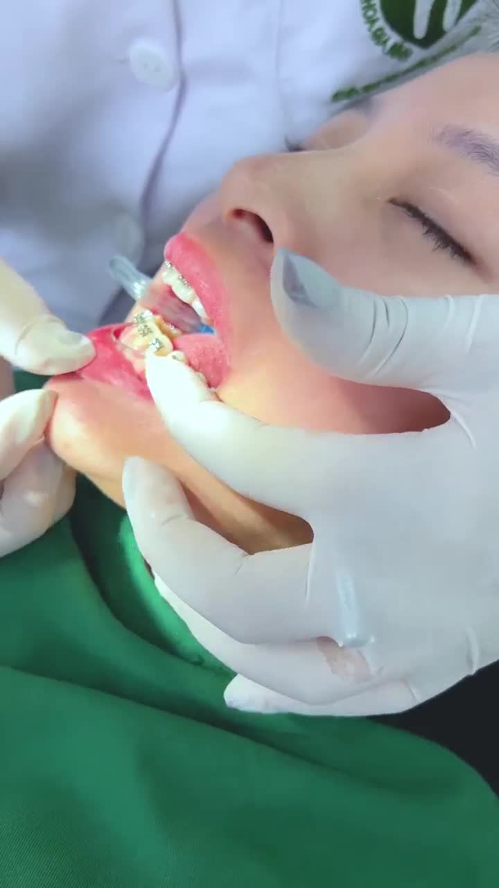 QUÁ TRÌNH ĐI DÂY CUNG CHO MỘT NỮ KHÁCH HÀNG