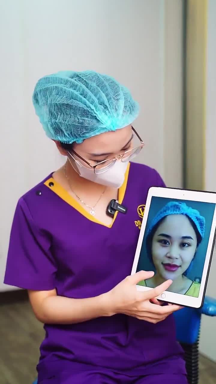 Chiêm ngưỡng sự thay đổi "ngoạn mục" của khách hàng sau 10 ngày Nâng mũi tại Dr.Hải Lê!