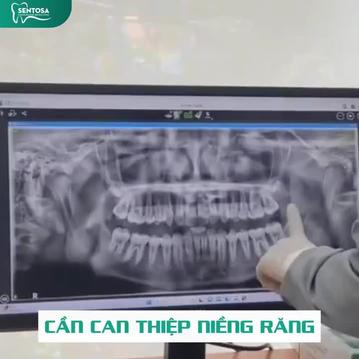 NIỀNG SỚM, LỚN XINH - TỰ TIN PHÁT TRIỂN CHỈ TỪ 8 TRIỆU ĐỒNG