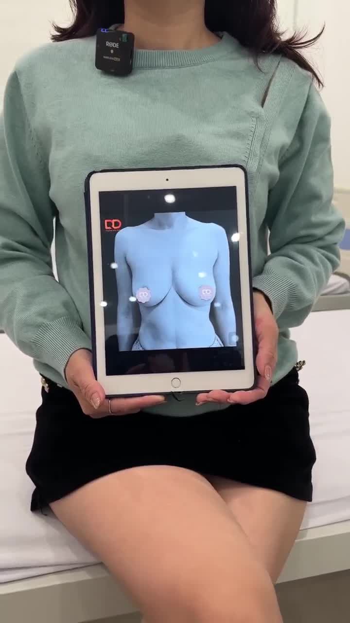 KHÁCH HÀNG FEEDBACK SAU KHI TREO SA TRỄ V1 TẠI DRD