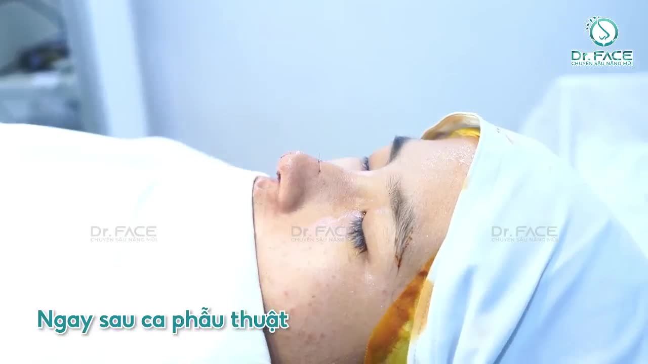 "Vừa Tròn 18 Tuổi Em Nâng Mũi Liền Luôn"