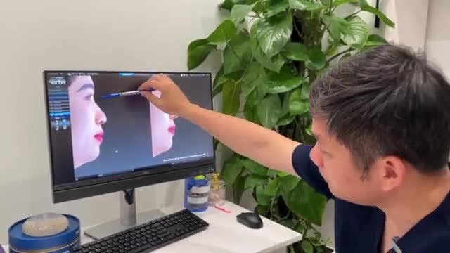 BÁC SĨ ĐIỀN TƯ VẤN KHÁCH HÀNG THỰC HIỆN TIỂU PHẪU NÂNG MŨI