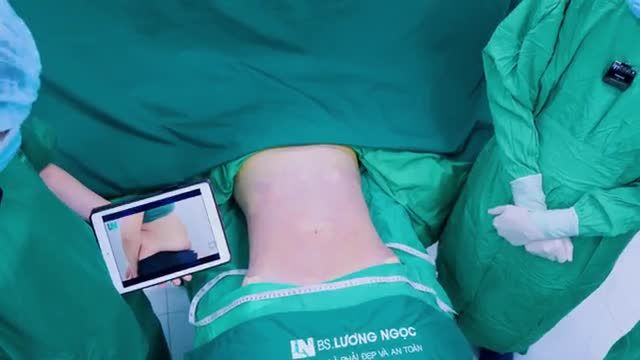 Giảm hơn 20CM, vòng eo thon gọn thắt đáy. Da co hồi phẳng phiu, ôm s.á.t vào cơ. Đường cong body nuột nà, quyến rũ