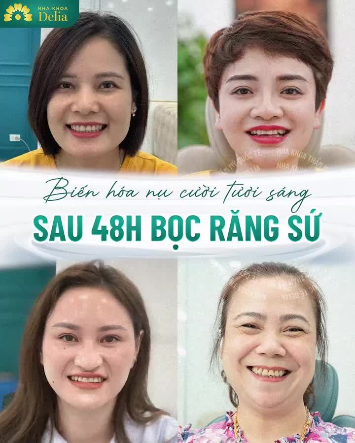 KHẮC PHỤC TRIỆT ĐỂ RĂNG Ố VÀNG CHỈ SAU 2 LẦN HẸN