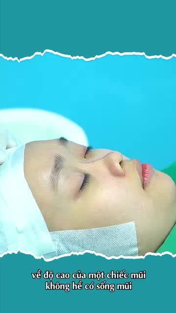 Nghe bác sĩ phân tích “TẤT TẦN TẬT” về CÁCH NÂNG MŨI nè...