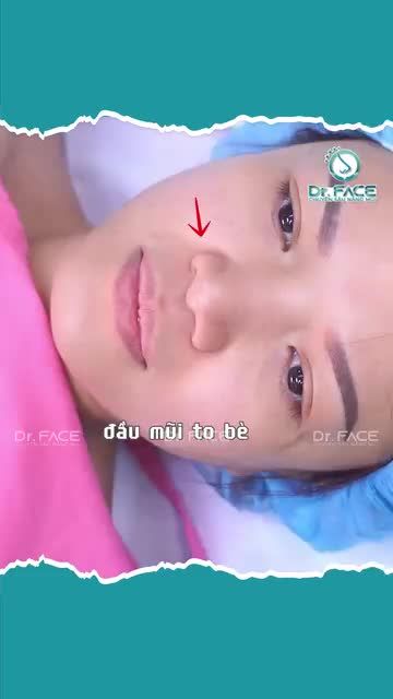 ĐẦU MŨI GÌ MÀ LỆCH 1 BÊN LUÔN