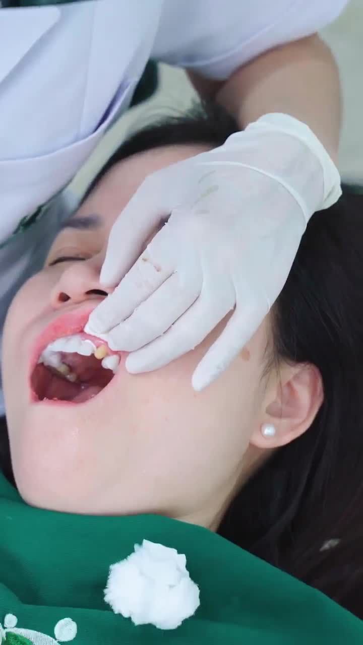 QUÁ TRÌNH THẨM MỸ 18 ĐƠN VỊ SỨ CAO CẤP CHO NỮ KHÁCH HÀNG