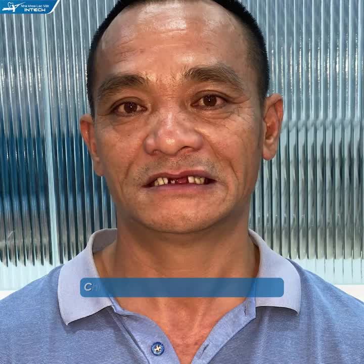 HÀNH TRÌNH TÌM LẠI NỤ CƯỜI BỀN VỮNG TRỌN ĐỜI